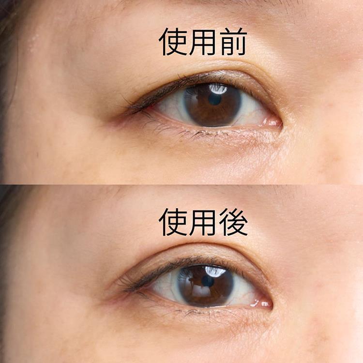 アイクット 接着リフティングタイプ